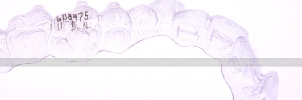 ortodoncia invisible invisalign