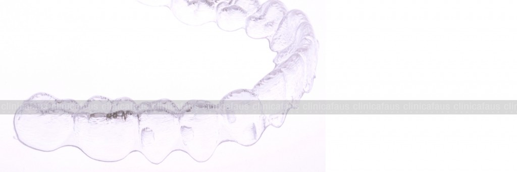 ortodoncia invisible invisalign valencia