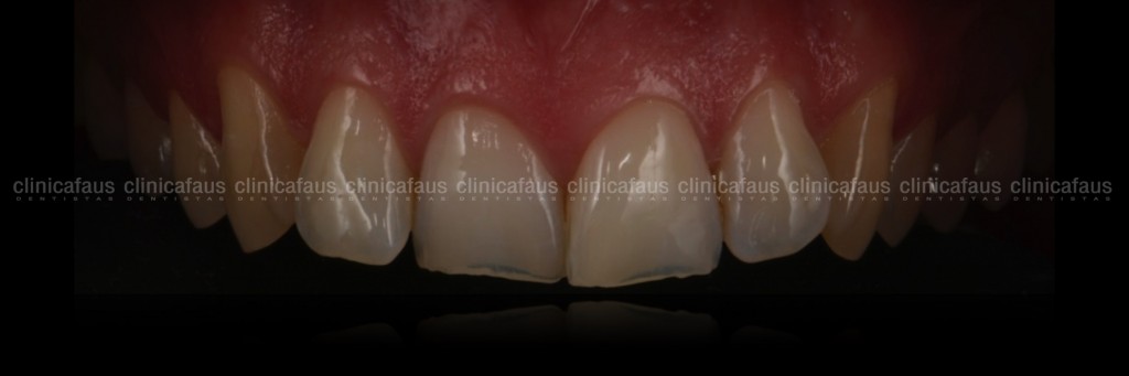 estetica dental valencia dentista clinica dental algemesi