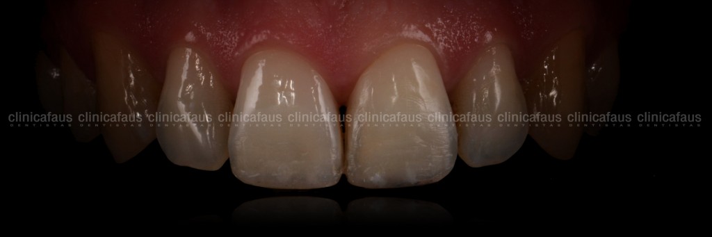 estetica dental valencia dentista clinica dental algemesi