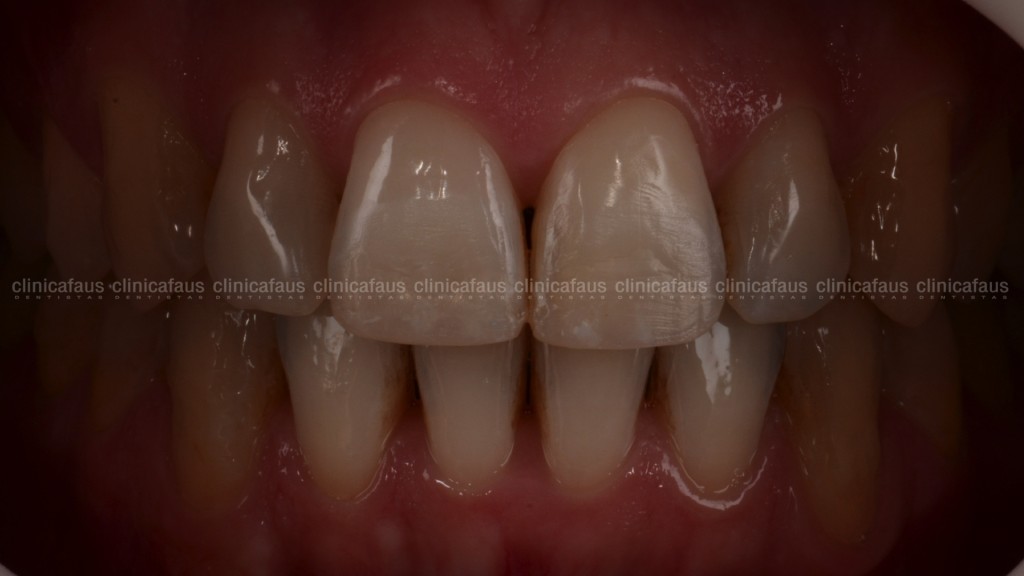 estetica dental valencia dentista clinica dental algemesi