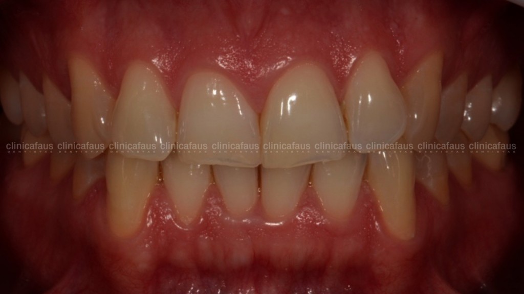 estetica dental valencia dentista clinica dental algemesi