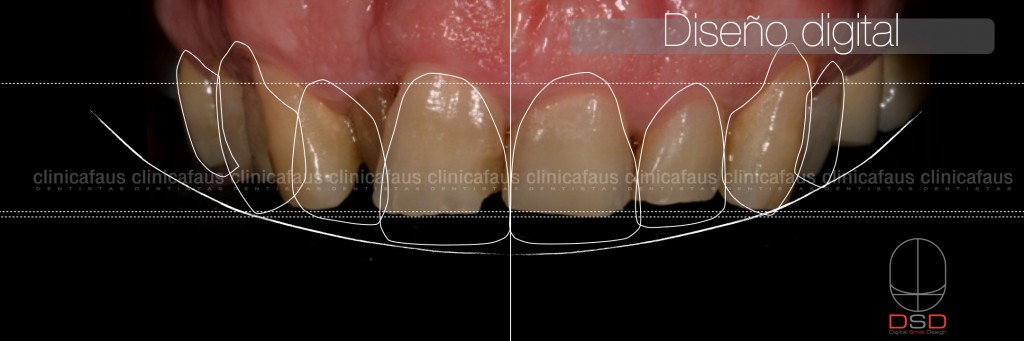 dentista algemesi clinica dental alzira sueca carcaixent valencia