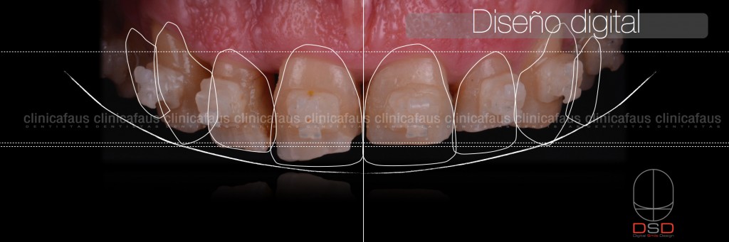 dentista algemesi clinica dental alzira sueca carcaixent valencia