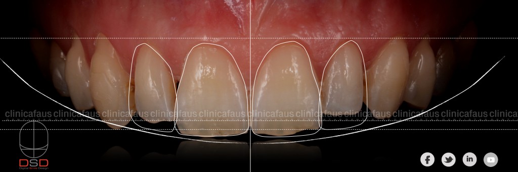 dentista en algemesi clinica dental valencia sueca cullera 