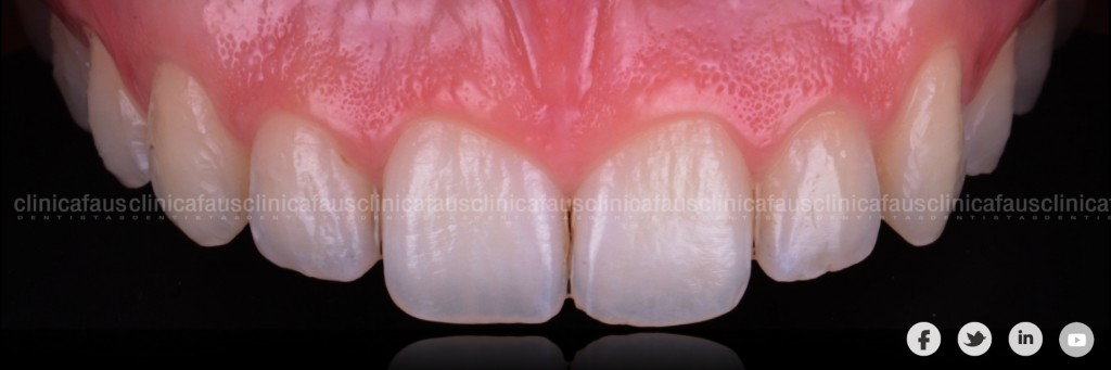 dentista especialista ortodocnia invisible valencia sueca cullera carcaixent
