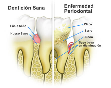 Periodoncia algemesi valencia