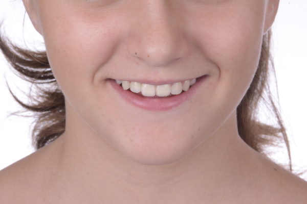 ortodoncia valencia