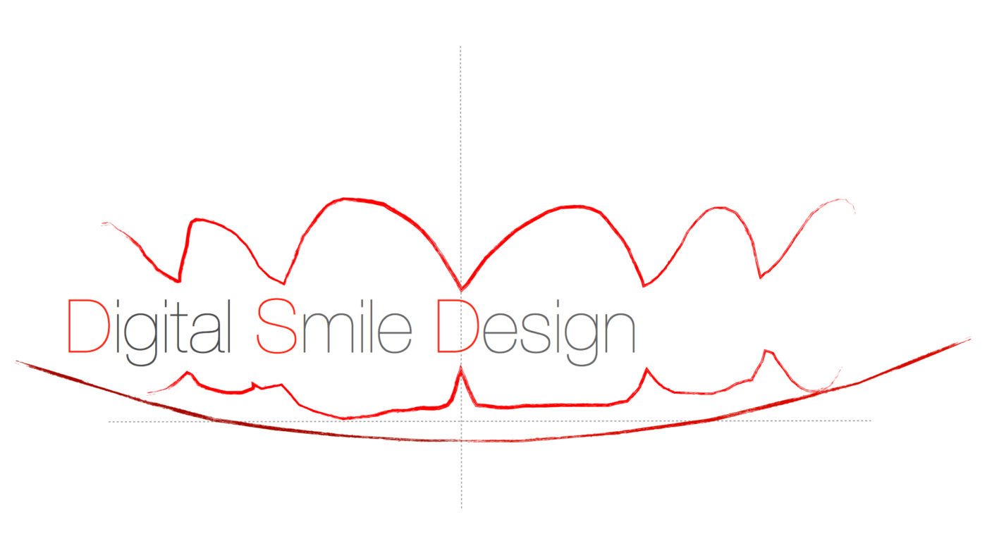 digital smile design