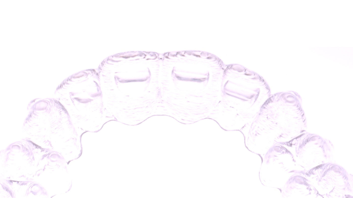 ortodoncia invisible Invisalign valencia