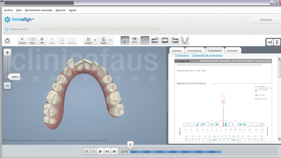 invisalign valencia