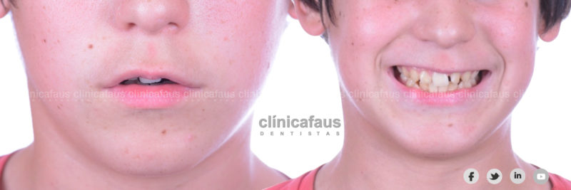 clinica dental valencia algemesi alzira carcaixent sueca cullera dentista ortodoncia