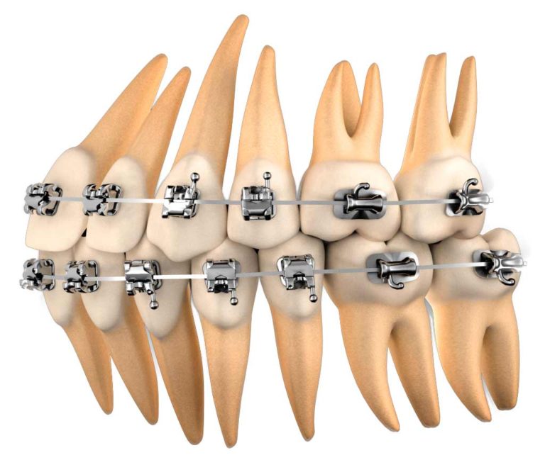 Autoligado Clínica Faus